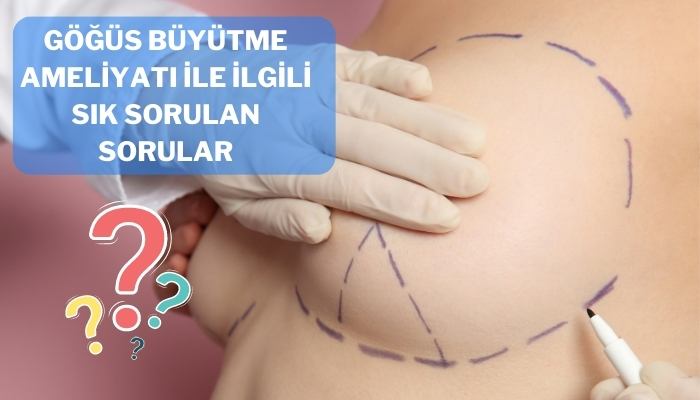 Göğüs Büyütme Ameliyatı İle İlgili Sık Sorulan Sorular