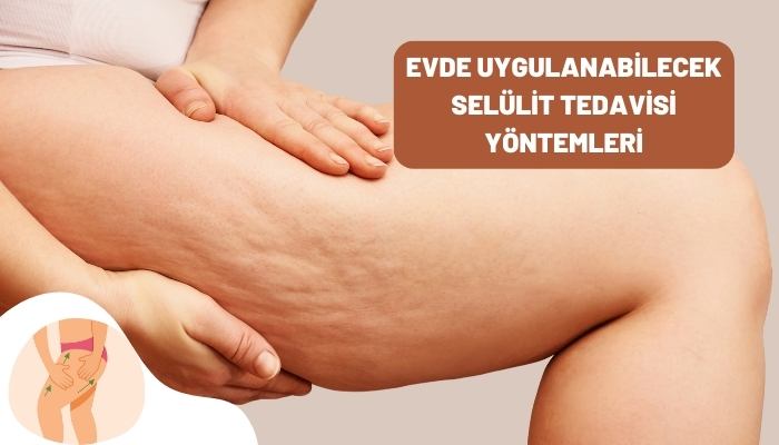 Selülit Nedir ? Evde Uygulanabilecek Selülit Tedavisi Yöntemleri