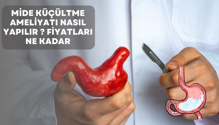 Mide Küçültme Ameliyatı Nasıl Yapılır